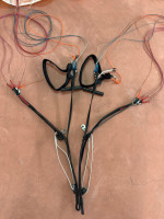 Skywalk X-ALPS 5, 95+, 2024, (75-97kg), 100h